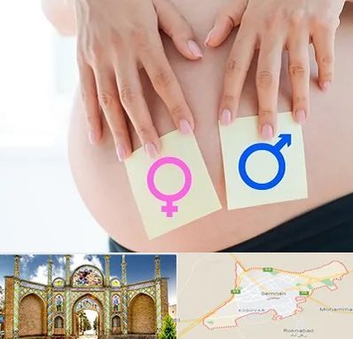 کلینیک تعیین جنسیت در سمنان