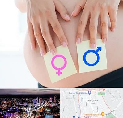 کلینیک تعیین جنسیت در گلسار رشت 