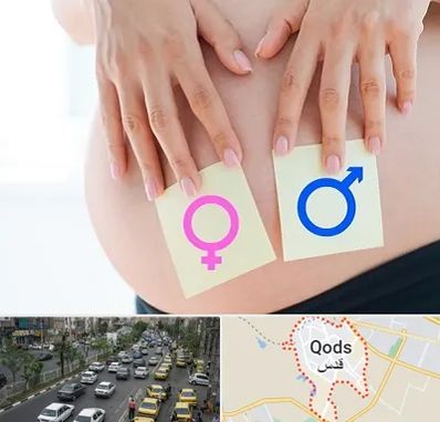 کلینیک تعیین جنسیت در شهر قدس