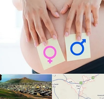 کلینیک تعیین جنسیت در بیجار