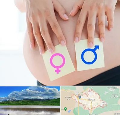 کلینیک تعیین جنسیت در مرند