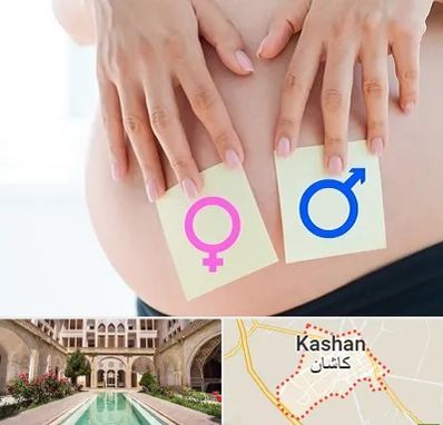 کلینیک تعیین جنسیت در کاشان