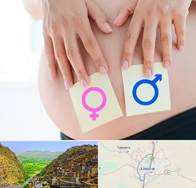 کلینیک تعیین جنسیت در کامیاران