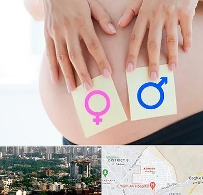 کلینیک تعیین جنسیت در عظیمیه کرج 