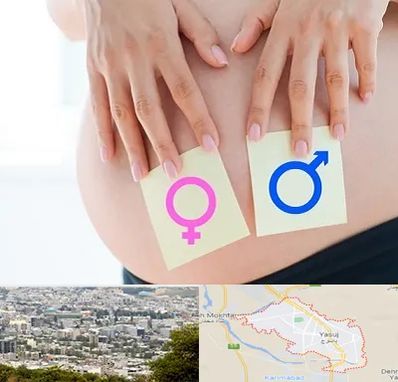 کلینیک تعیین جنسیت در یاسوج