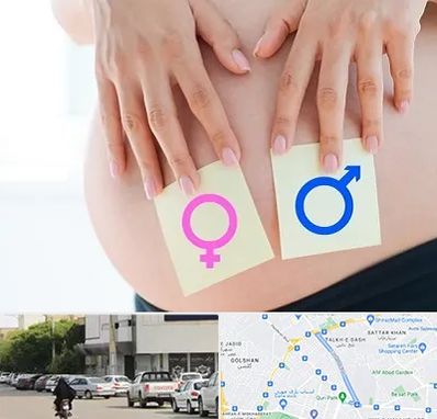 کلینیک تعیین جنسیت در قدوسی شرقی شیراز