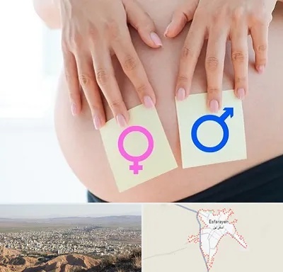 کلینیک تعیین جنسیت در اسفراین