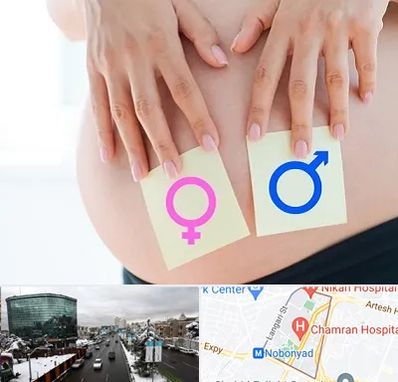 کلینیک تعیین جنسیت در اقدسیه 