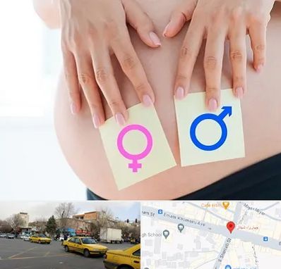 کلینیک تعیین جنسیت در شهناز تبریز