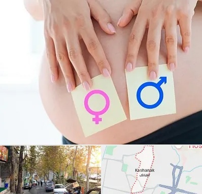 کلینیک تعیین جنسیت در کاشانک