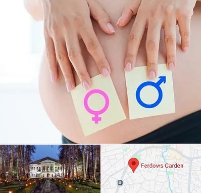 کلینیک تعیین جنسیت در باغ فردوس