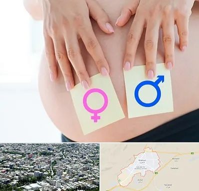 کلینیک تعیین جنسیت در شاهرود