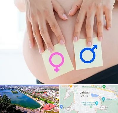 کلینیک تعیین جنسیت در لاهیجان