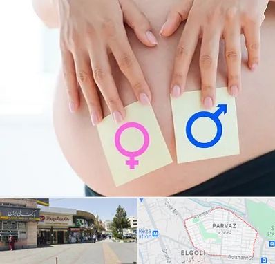 کلینیک تعیین جنسیت در پرواز تبریز