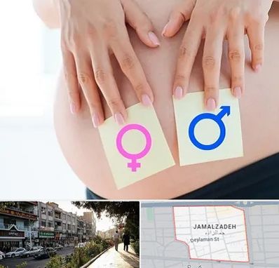 کلینیک تعیین جنسیت در خیابان جمالزاده