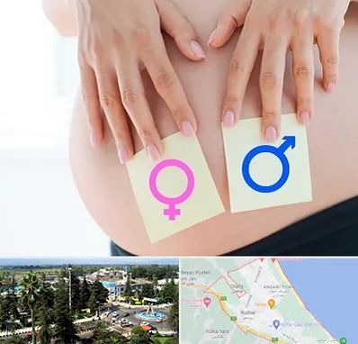 کلینیک تعیین جنسیت در رودسر