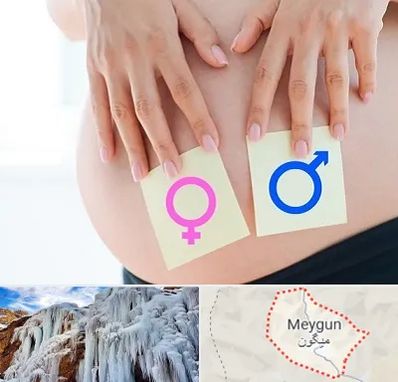 کلینیک تعیین جنسیت در میگون