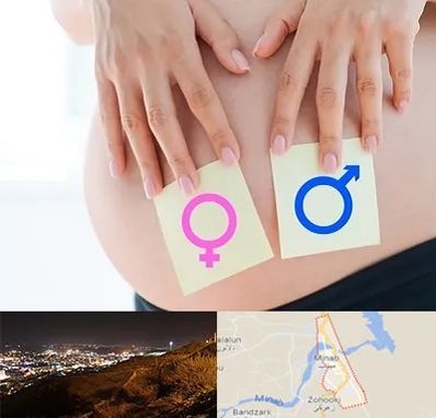 کلینیک تعیین جنسیت در میناب