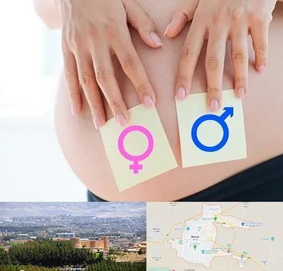کلینیک تعیین جنسیت در بیرجند