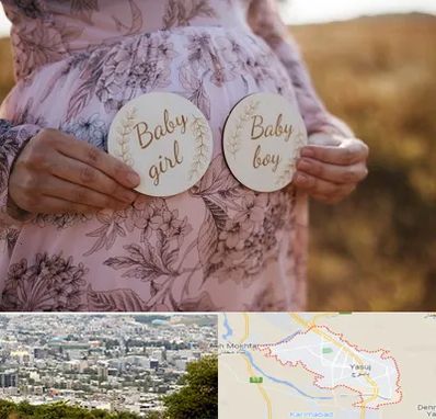 دکتر زنان تعیین جنسیت در یاسوج