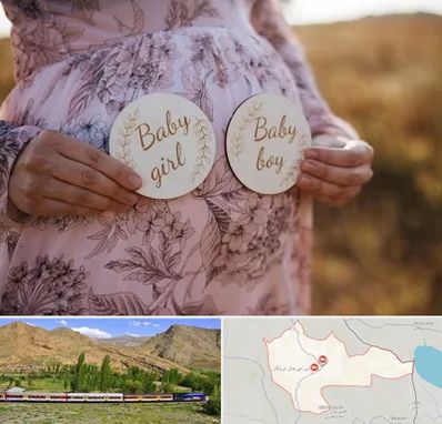 دکتر زنان تعیین جنسیت در خاش