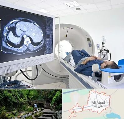 مرکز تصویر برداری پزشکی در علی آباد کتول