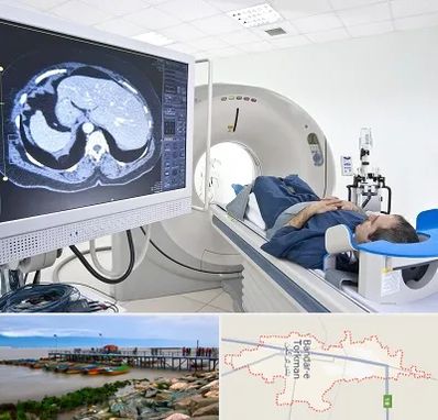 مرکز تصویر برداری پزشکی در بندر ترکمن