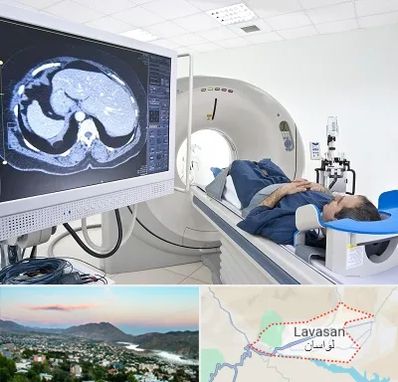 مرکز تصویر برداری پزشکی در لواسان