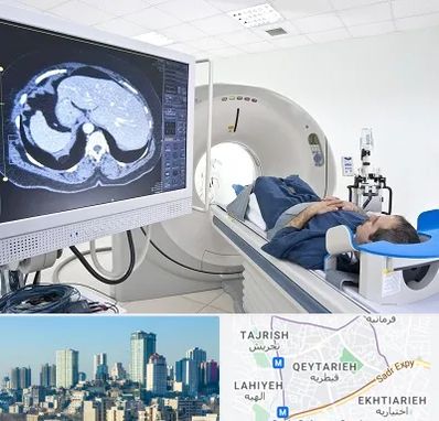 مرکز تصویر برداری پزشکی در قیطریه 
