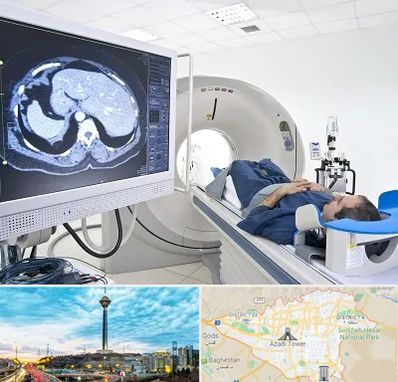 مرکز تصویر برداری پزشکی در تهران