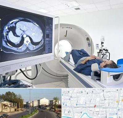 مرکز تصویر برداری پزشکی در ضیابری رشت