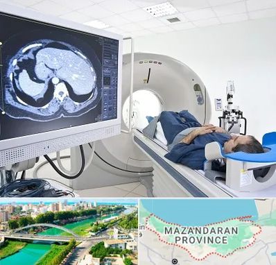 مرکز تصویر برداری پزشکی در مازندران