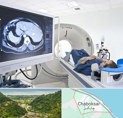مرکز تصویر برداری پزشکی در چابکسر