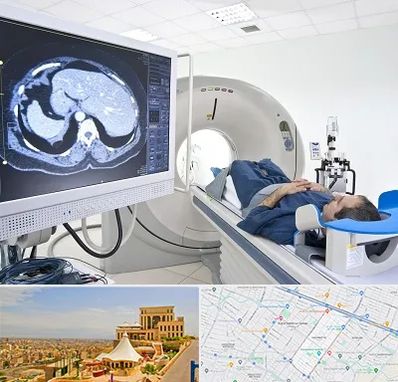 مرکز تصویر برداری پزشکی در هاشمیه مشهد