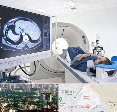 مرکز تصویر برداری پزشکی در عظیمیه کرج 