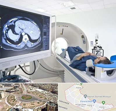 مرکز تصویر برداری پزشکی در پرند