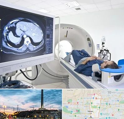 مرکز تصویر برداری پزشکی در منطقه 2 تهران