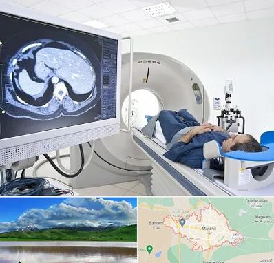 مرکز تصویر برداری پزشکی در مرند
