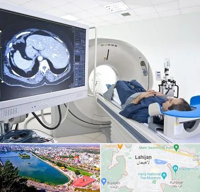 مرکز تصویر برداری پزشکی در لاهیجان