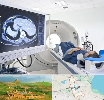 مرکز تصویر برداری پزشکی در آذربایجان غربی