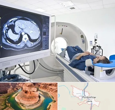 مرکز تصویر برداری پزشکی در پلدختر
