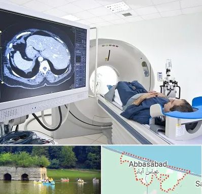 مرکز تصویر برداری پزشکی در عباس آباد