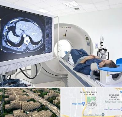مرکز تصویر برداری پزشکی در اکباتان 