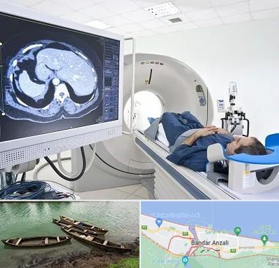 مرکز تصویر برداری پزشکی در بندر انزلی