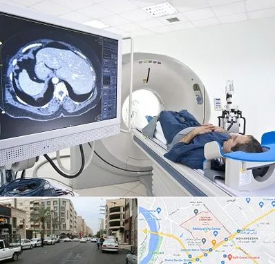 مرکز تصویر برداری پزشکی در زیتون کارمندی اهواز