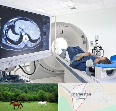 مرکز تصویر برداری پزشکی در چمستان