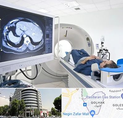 مرکز تصویر برداری پزشکی در قلهک 