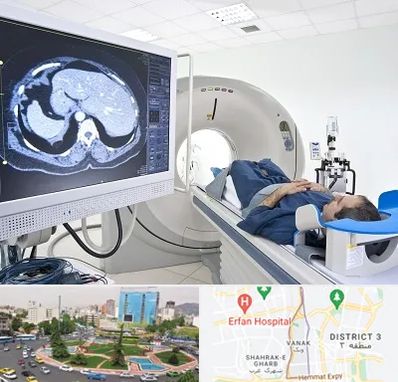 مرکز تصویر برداری پزشکی در ونک 