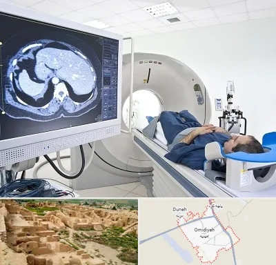 مرکز تصویر برداری پزشکی در امیدیه