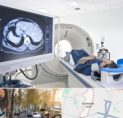 مرکز تصویر برداری پزشکی در کاشانک